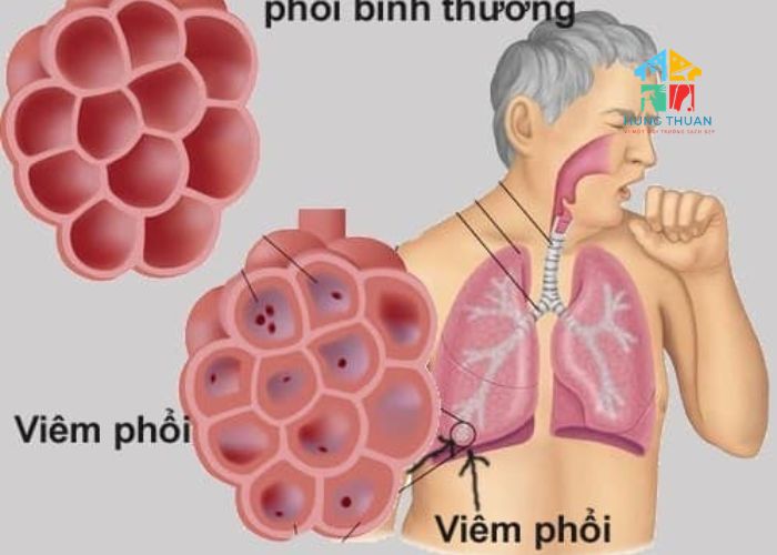 Tác hại của việc không giặt nệm Tác hại của việc không giặt nệm