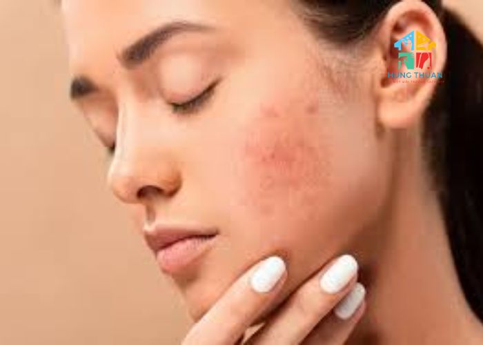 Tác hại của việc không giặt nệm (2) Tác hại của việc không giặt nệm (2)